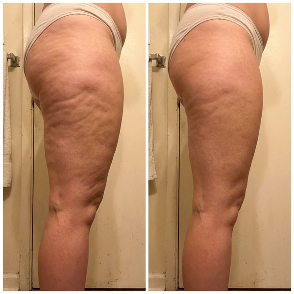 Swollen Ankles and Legs From Sitting: What Helps