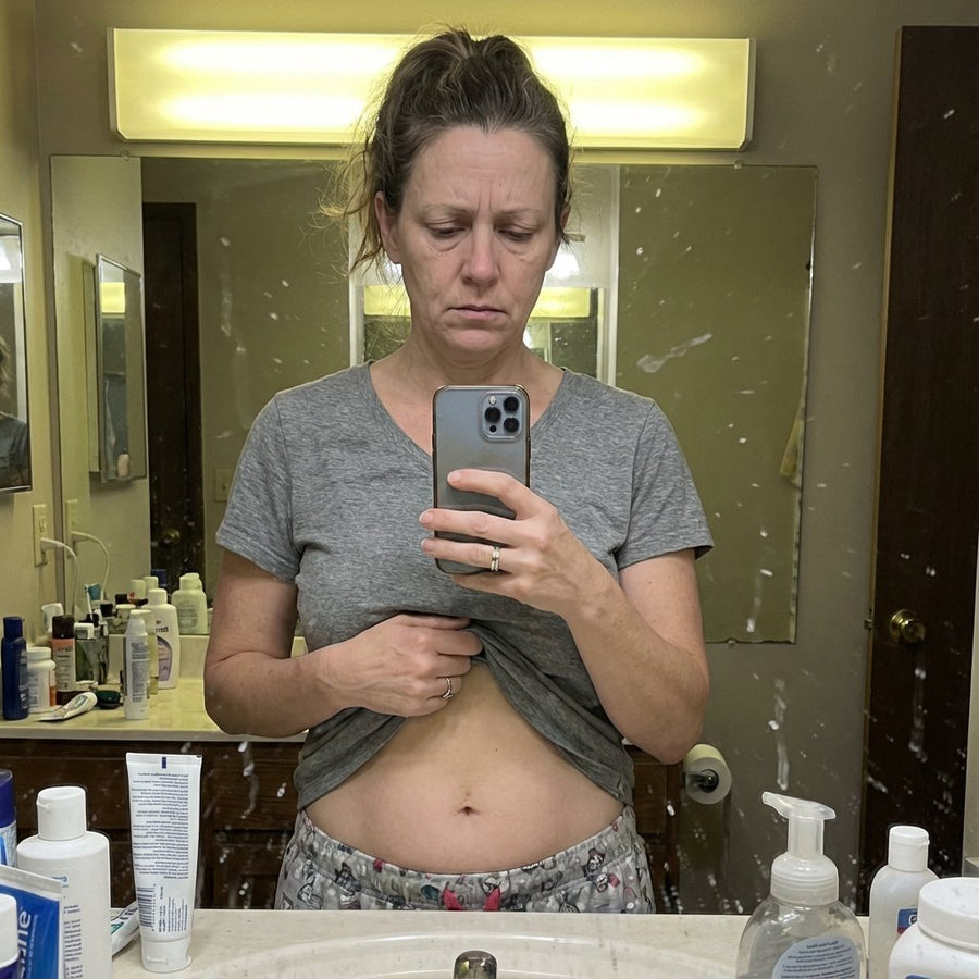 Why Do I Feel Puffy? Understanding Fluid Retention