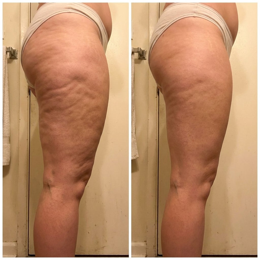 Swollen Ankles and Legs From Sitting: What Helps
